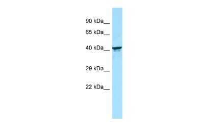 Western Blot: KIR2DL5B Antibody [NBP3-09480]